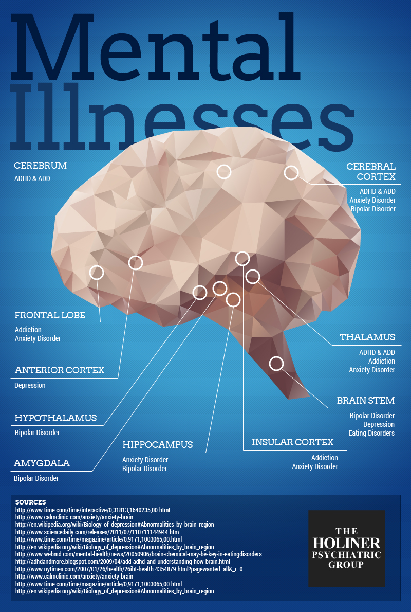 Where Does Mental Illness Occur in Your Brain? - Holiner Psychiatric Group